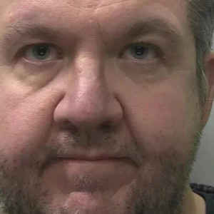 Disgraced perverted vascular surgeon Andrew Neil Hopper defrauded his insurance policies after infecting his own legs because of a sexual fetish in amputations